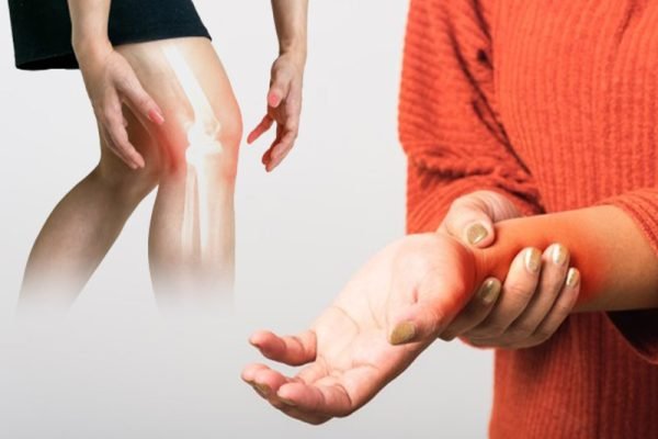 big_symptomsofarthritis